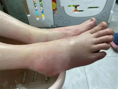 细节介绍